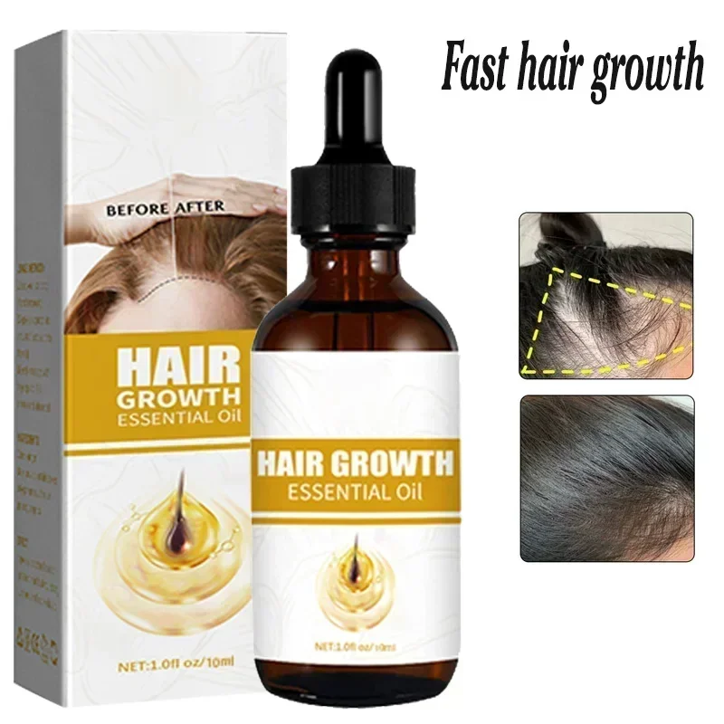 Hair Growth Oil for Men Biotin Fast Treatment Baldness Serum Hair Growth Oil for Black Women Hair Care Treatment beard growth