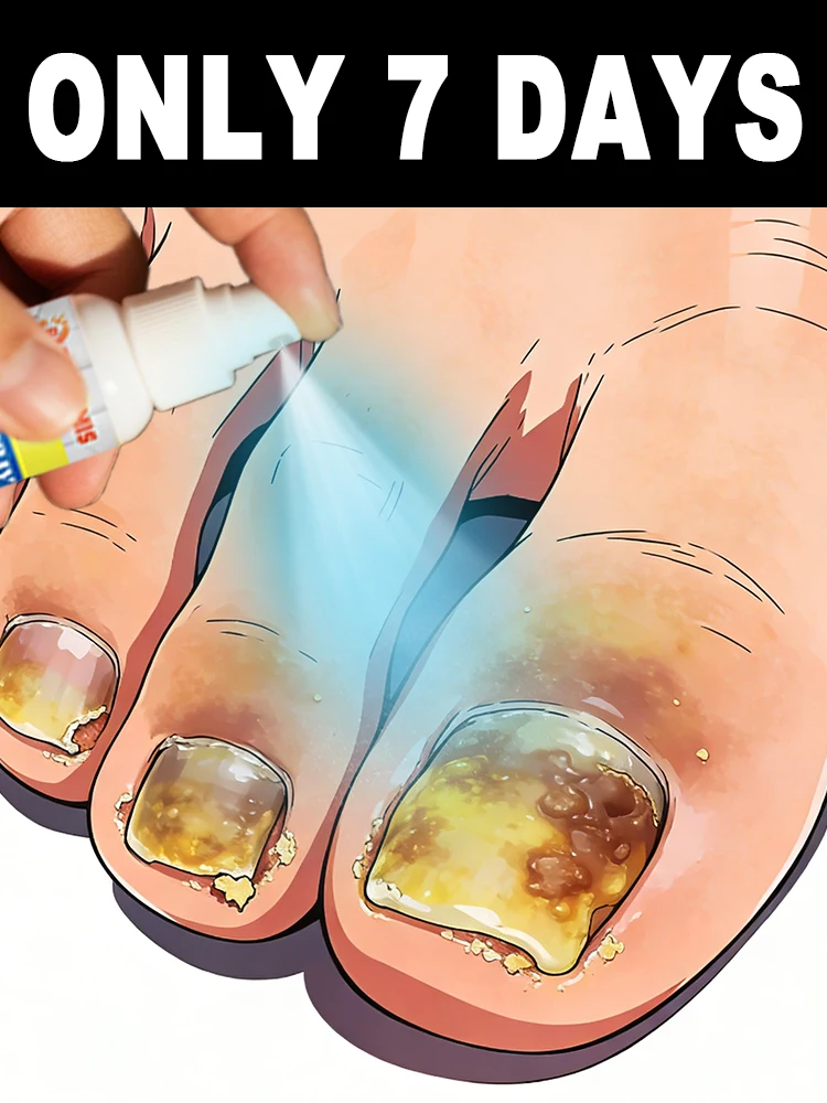 

Worried about spreading fungal nail fungus to your family ᵁˢᵉ ᵒᵘʳ ᵃⁿᵗⁱᵇᵃᶜᵗᵉʳⁱᵃˡ ˢᵖʳᵃʸ ᶠᵒʳ ᵖᵉᵃᶜᵉ