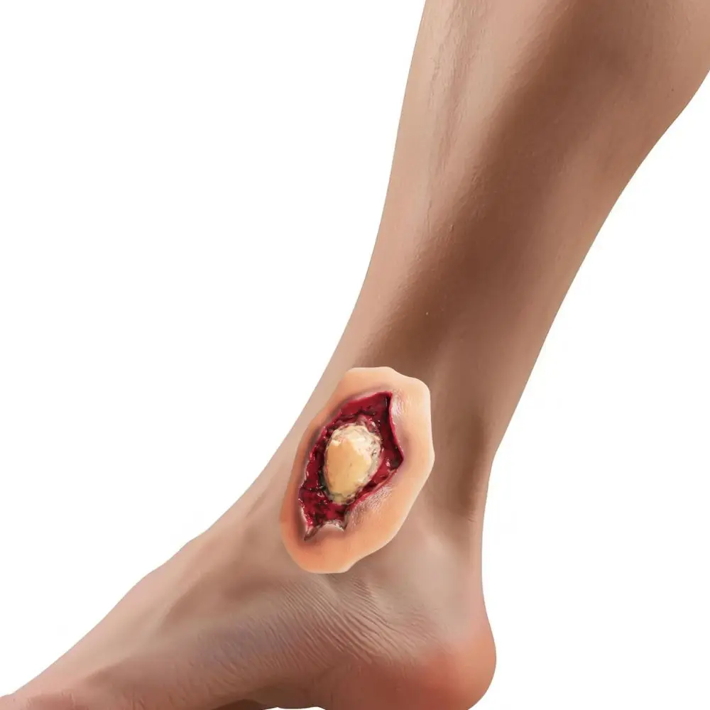 Ultrassist Ankle Fracture Wound Moulage Self-Adhesive Silicone Model Injury Simulator Exposed Bone & Torn Flesh for Medic Train