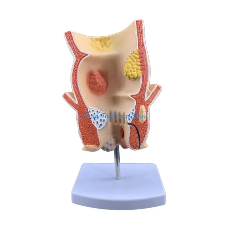 H37F Anatomy Display Model for Pathology Lessons, PVC 3D Demonstration Teaching Aid