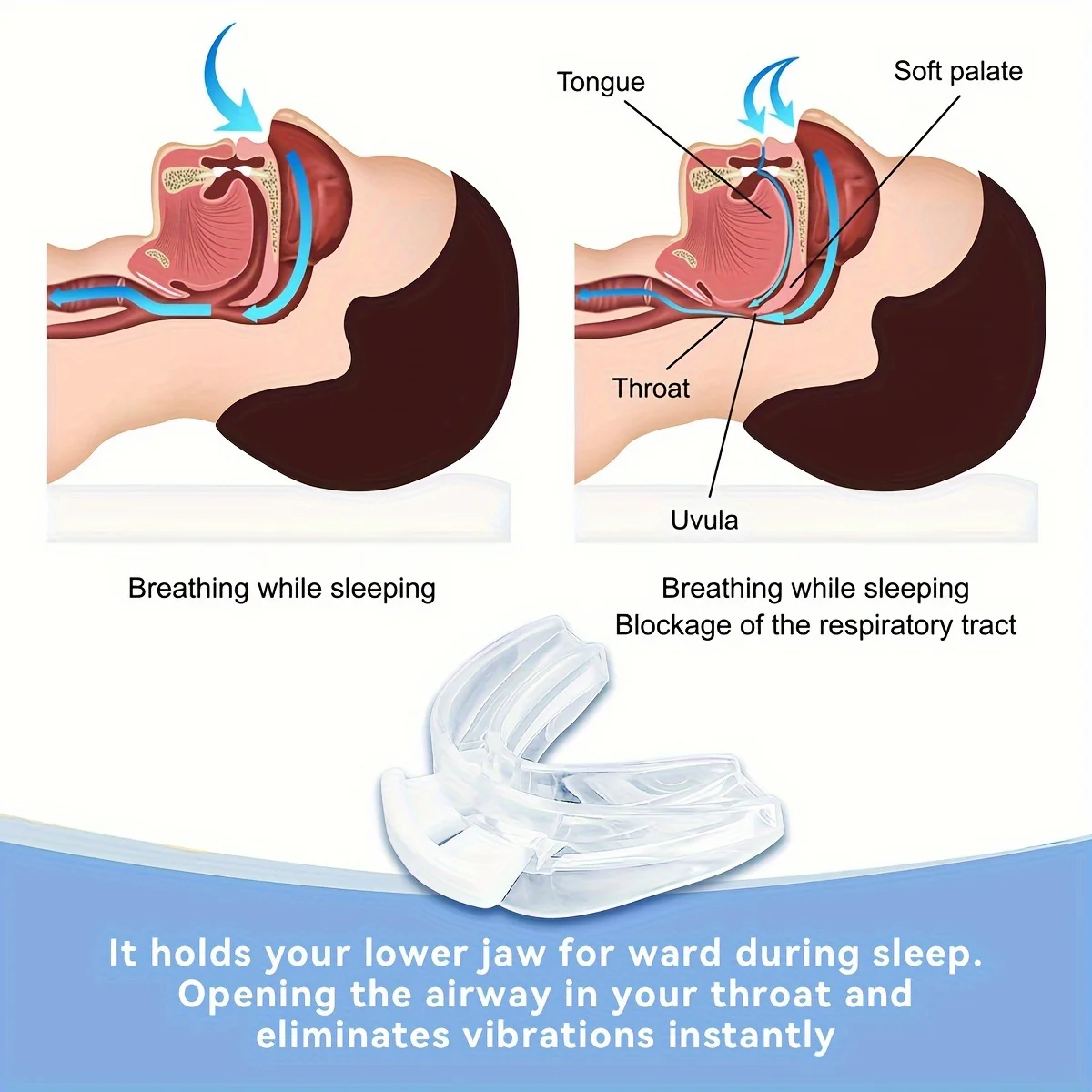 1pc BPA Free Anti Snore Mouthpiece, Custom Fit Adjustable No Snore Device, Teeth Grinding Solution for High Quality Sleep