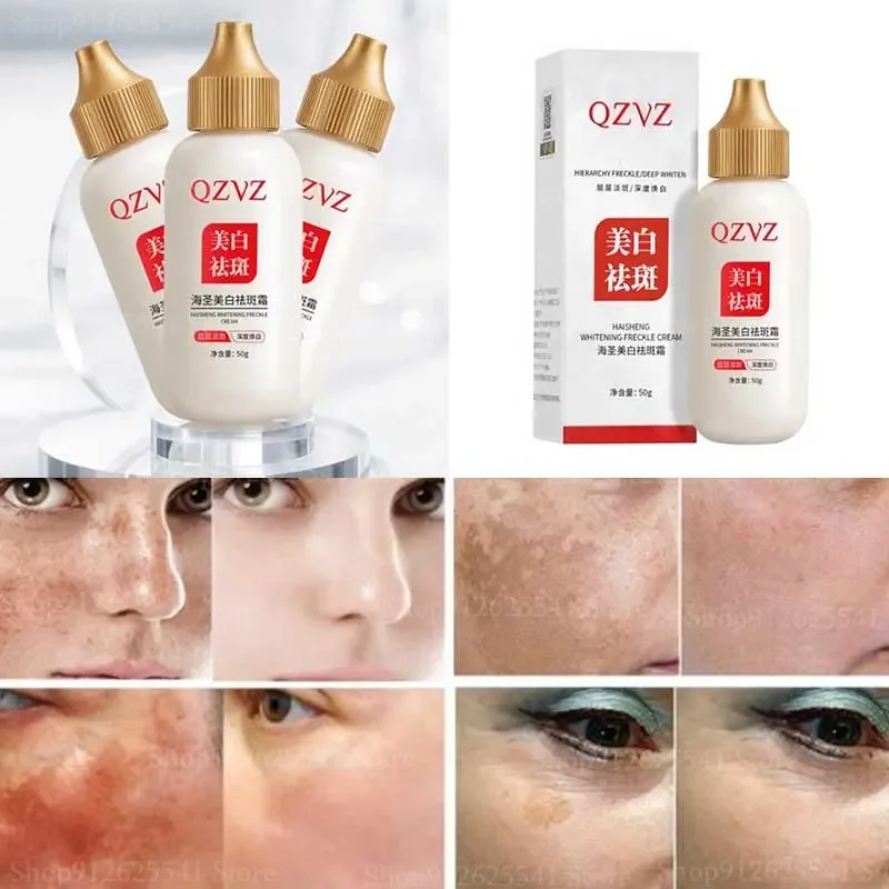 

50g Effective Spot Remover Face Cream Whiten Dark Spots Pigment Light Skin Freckle Age Spots Sunspots Melasma Corrector