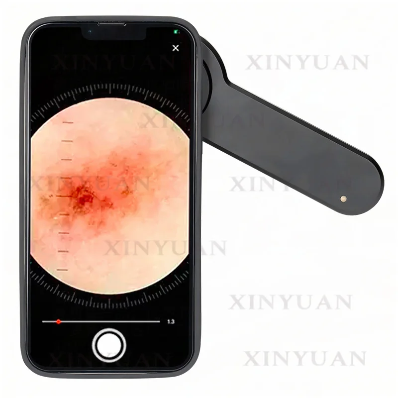 Digital Skin Mirror with Wood Lamp Mode 10x Magnification Polarized UV 3 Components 3 Optical Design for Beauty And Personal Car