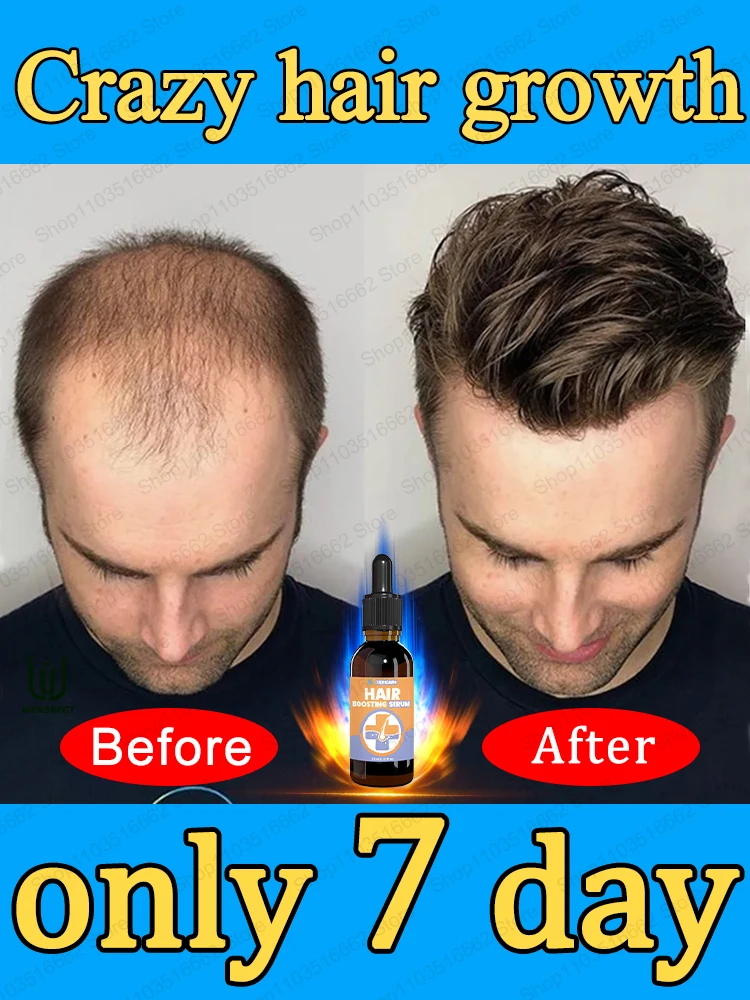 98% of buyers buy again, have more and more hair, say goodbye to baldness, thick hair,Hot selling product.