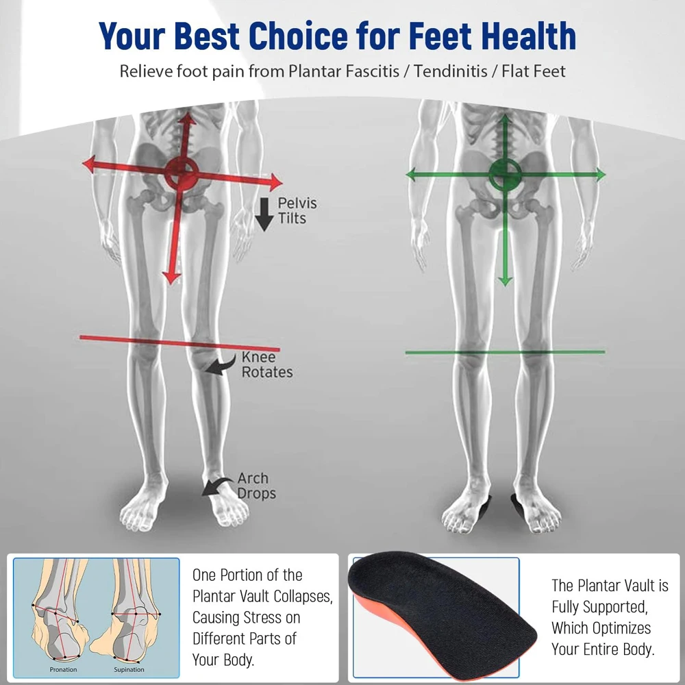 Plantar Fasciitis Half Insoles for Shoes Man Woman Flatfoot Arch Support Orthopedic Insole Sport Shock Absorption Shoe Insert