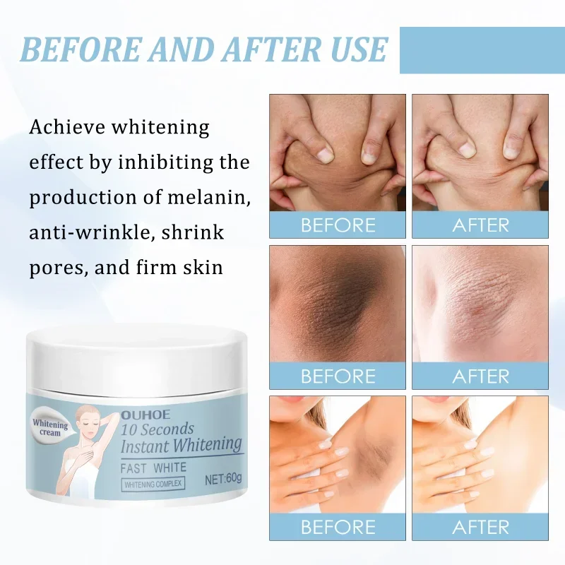 under arm Whitening Cream for women Underarm Bleaching Whiten Elbow Knee Brighten Intimate Parts Dark Spots Remove Melanin care