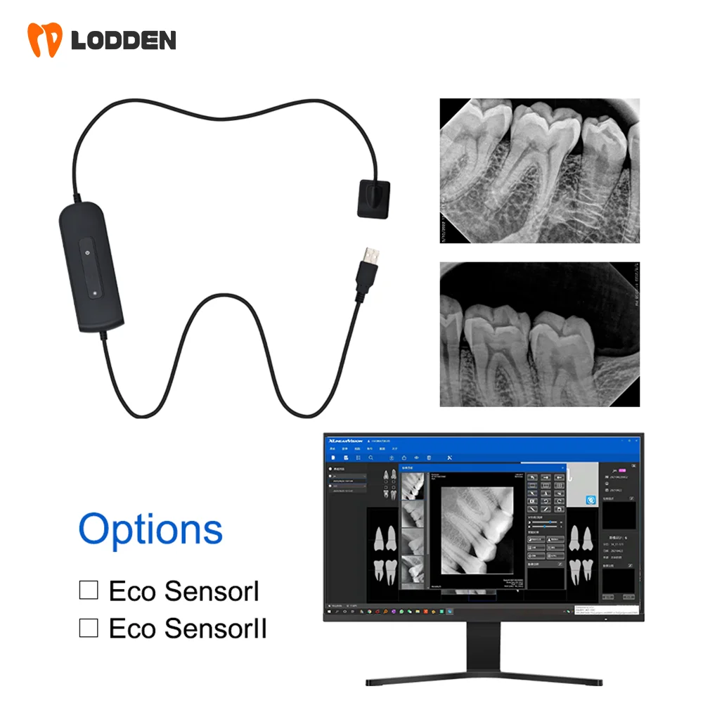 LODDEN Dental Intraoral X-RAY Sensor Medical Fast Transmission Digital Intraoral System Digital HD Image Dentistry Tools