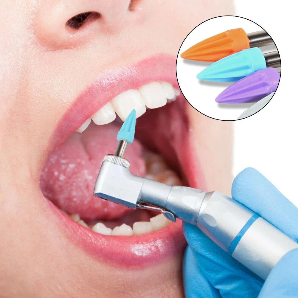 200pcs Dental Polishing Brushes Latch Type RA Shank 2.35mm Nylon Bristle Teeth Whitening Prophy Brushes for Oral Care