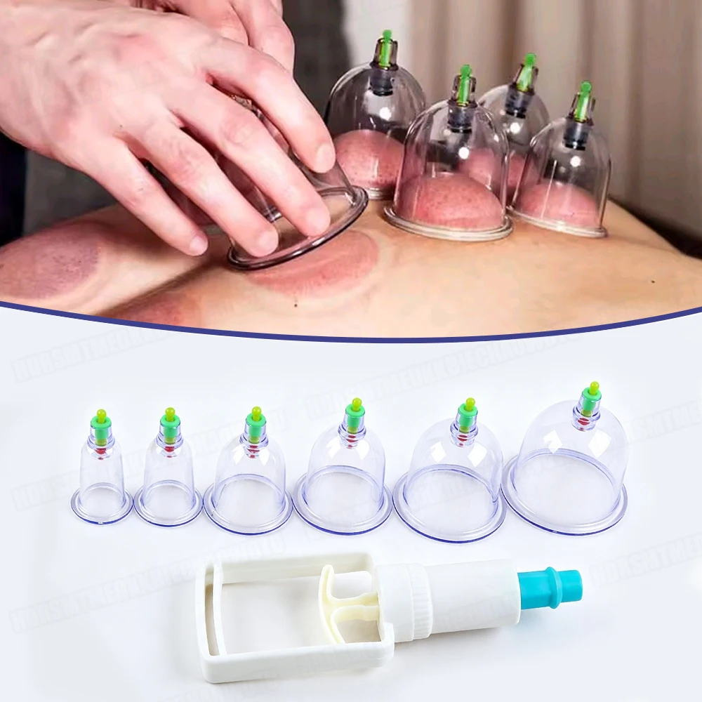 1Set Professional Vacuum Cupping Sets Suction Cups Back Massage Body Cup Detox Massage Body Cups Vacuum Cupping Massage Jars Kit