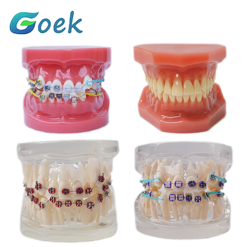 

Dental Teaching Model Ortho Metal Bracket Metal & Ceramic Dentistry Accessories Orthodontics False Teeth Modeling Resources