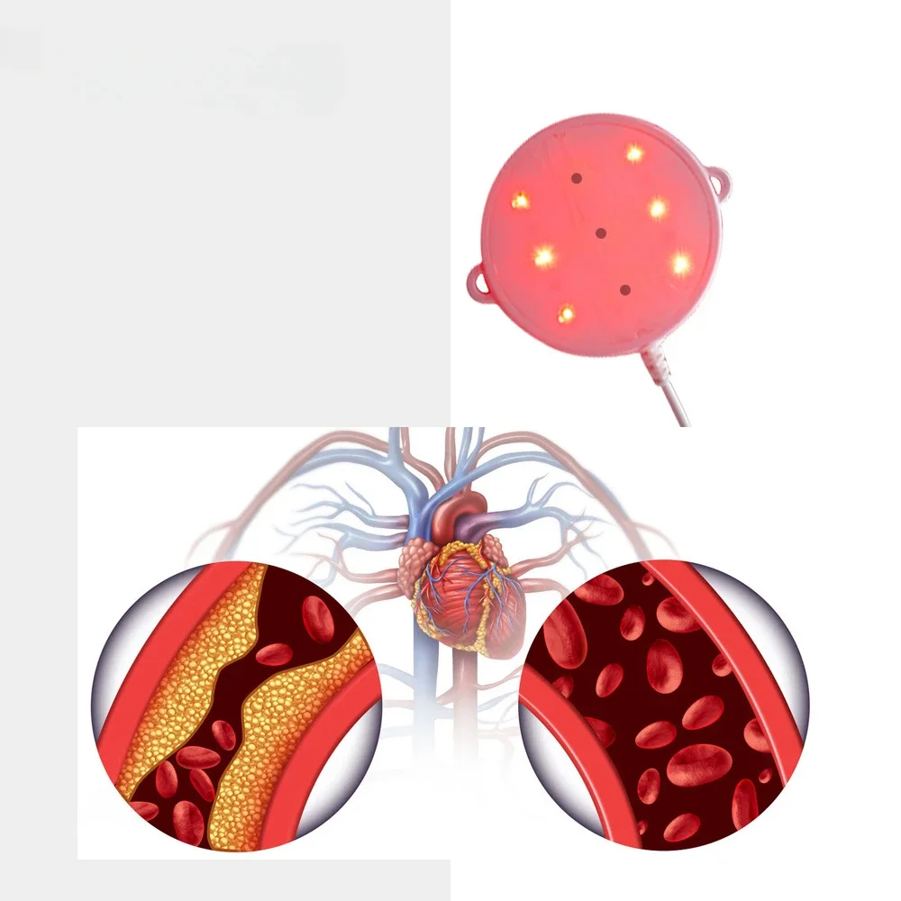 Masajeador de muñeca Dispositivo de terapia de luz roja LED Dispositivo de terapia infrarroja cercana redonda para el cuidado de la salud para la artritis de esguince de muñeca 650nm