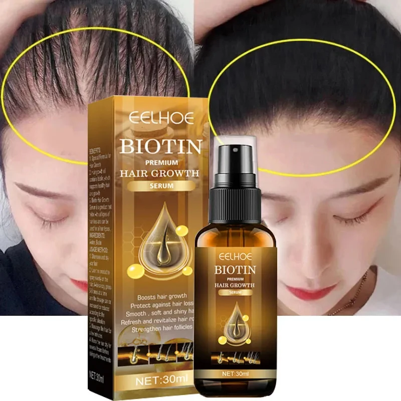 Biotin schnelle Haarwuchs mittel Anti Haarausfall Serum Spray verhindern Kahlheit Behandlung Kopfhaut Bart Schönheit Haarpflege produkt