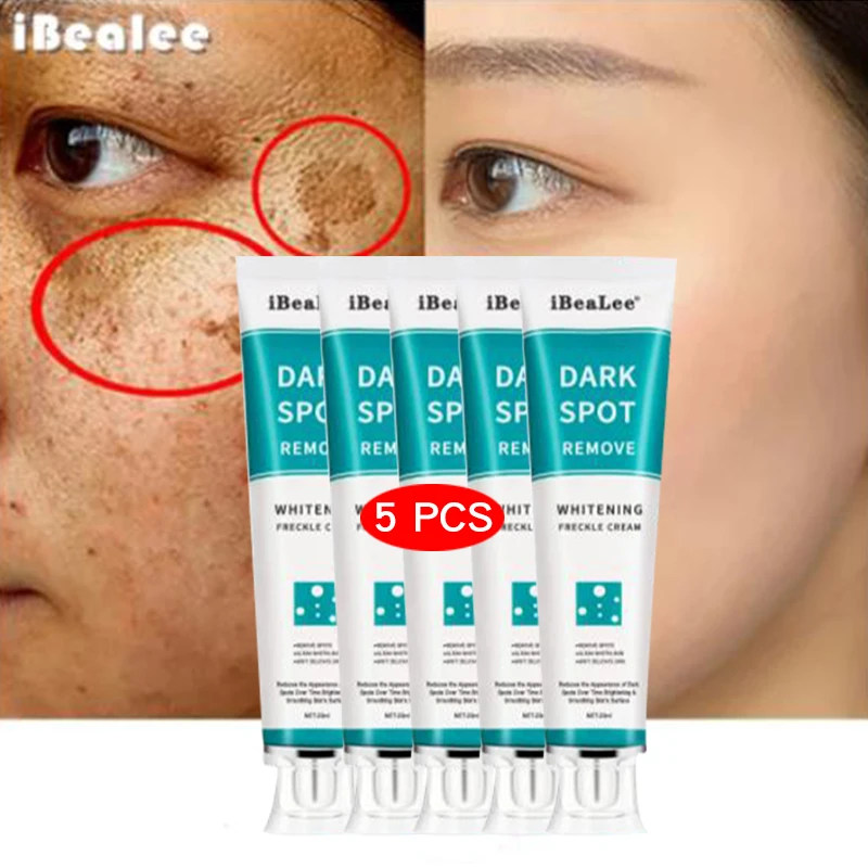 

Whitening Freckles Cream Remove Melasma Dark Spots Lighten Melanin Melasma Remover Moisturizing Brighten Face Skin Care