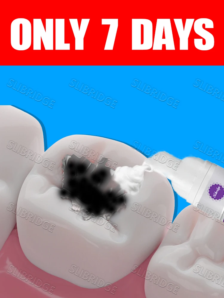 

2025 Hot Sale Cleaning Mousse solve various problems Intraoral care tools