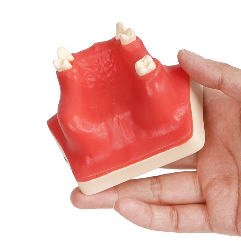 1pc Maxillary Sinus Teeth Model Upper Jaw Sinus Lift Implants Restoration Model Dentist Student Practice Studying Tools
