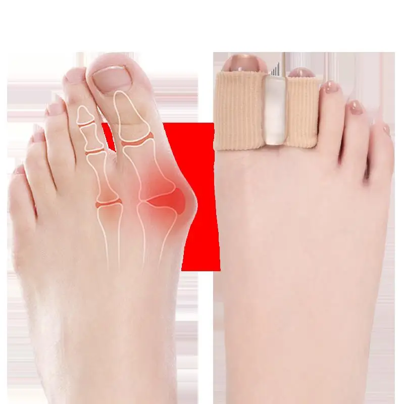 Kai Pu Big Toe Corrector Thumb Exostosis Separation Correction Split Toe Shoes Men Women Children Wearable Foot Mother