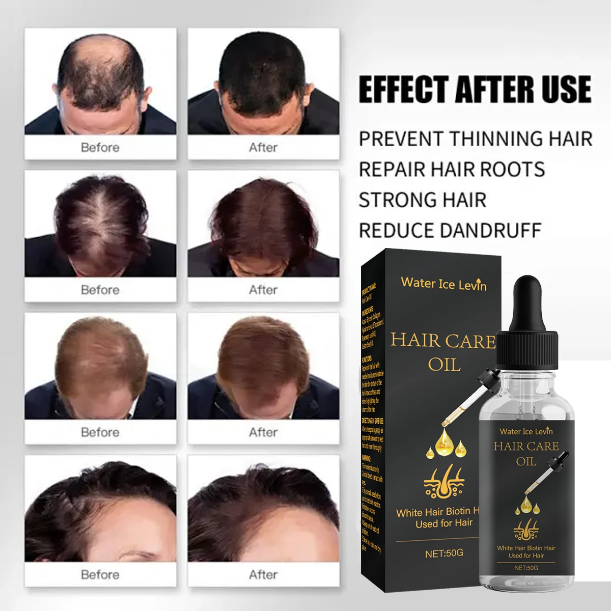 Hair Care Oil with Biotin - Fights White Hair & Boosts Moisture with Rosemary, Castor Oil, Collagen for Soft, Shiny Hair