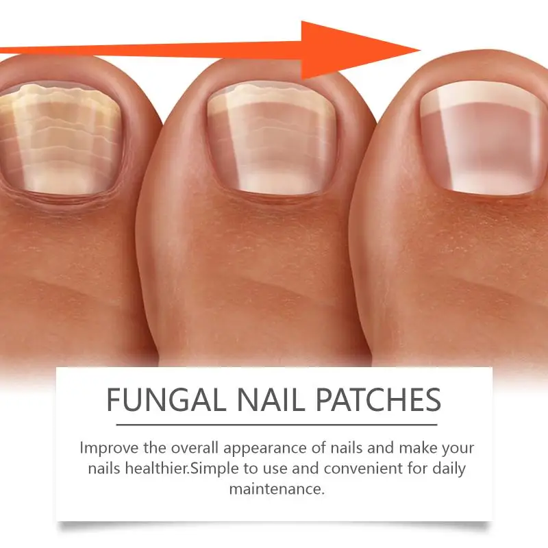 Portable Nail Care Patches 32PCS Gentle Restoration Pads for Fast Nail Recovery Easy Nail Health Solution for Everyday Use