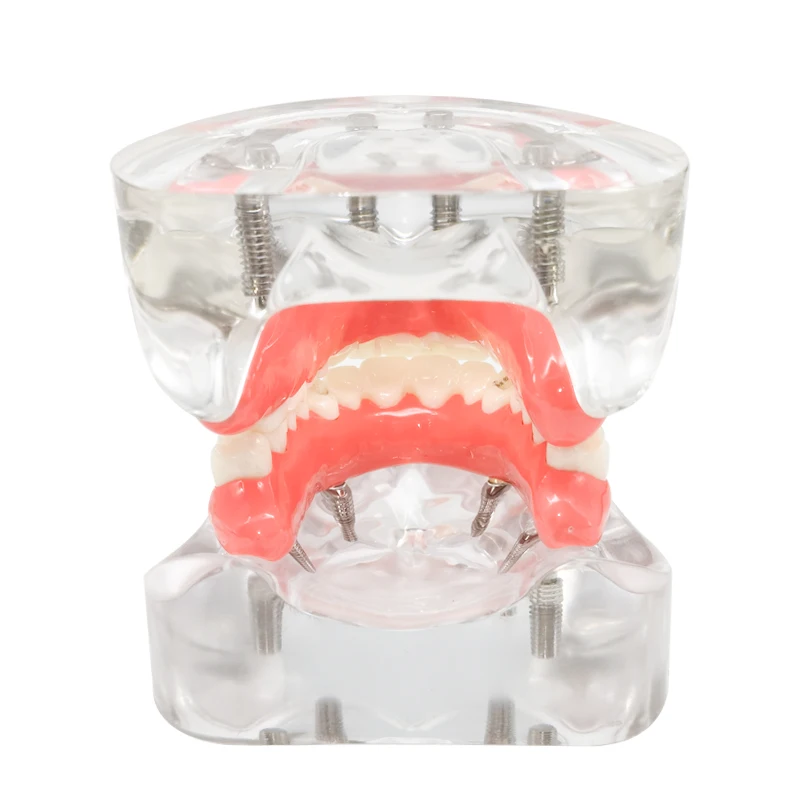 Thumbnail 4 - #67 Dental Teaching Models List of Top Picks