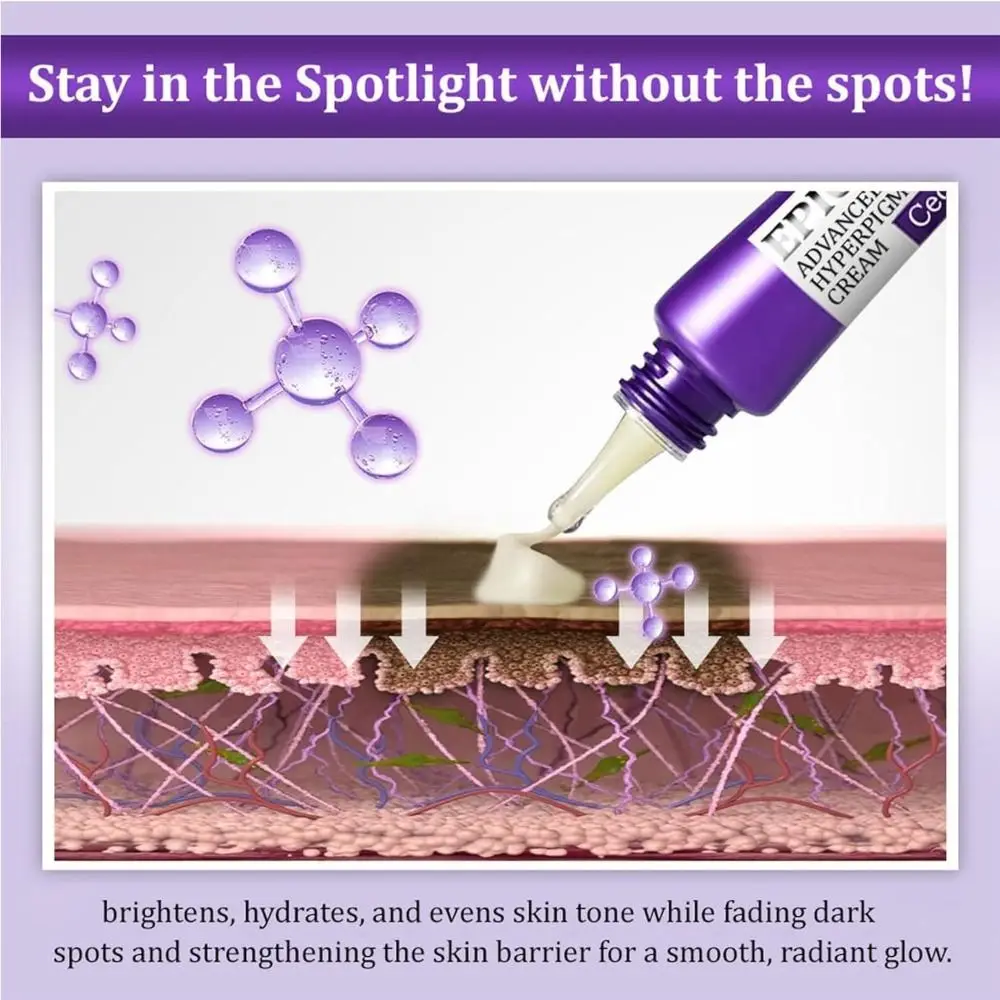 Diepe Reiniging Anti Hyperpigmentatie Crème Donkere Vlekken Remover Verhelderende Behandeling Gezichtscrème 20g Rimpel Remover Gezichtscrème