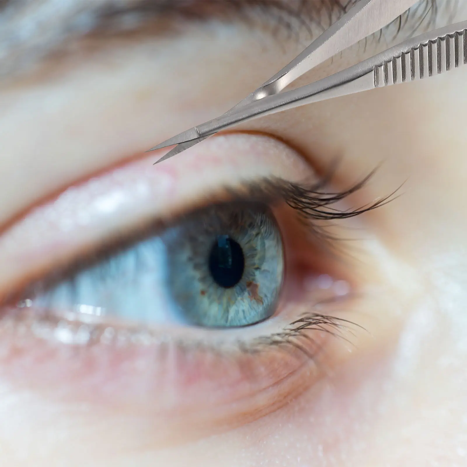 

Ножницы медицинские из нержавеющей стали для офтальмологических операций, инструмент для косметической коррекции, антикоррозийный хирургический инструмент для больниц