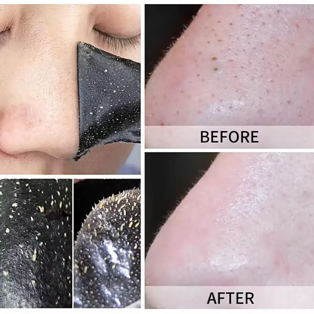 10Pcs Bamboo Carbon Nose Blackhead Remover Mask Nasal Strips Black Head Peel Off Sticker Face Acne Whitehead Pore Clean Patch