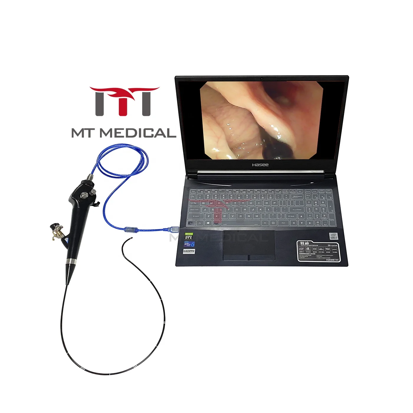 MT MEDICAL Equipment Portable USB Series Nasopharyngoscope Bronchoscope Cystoscope Video Laryngoscope