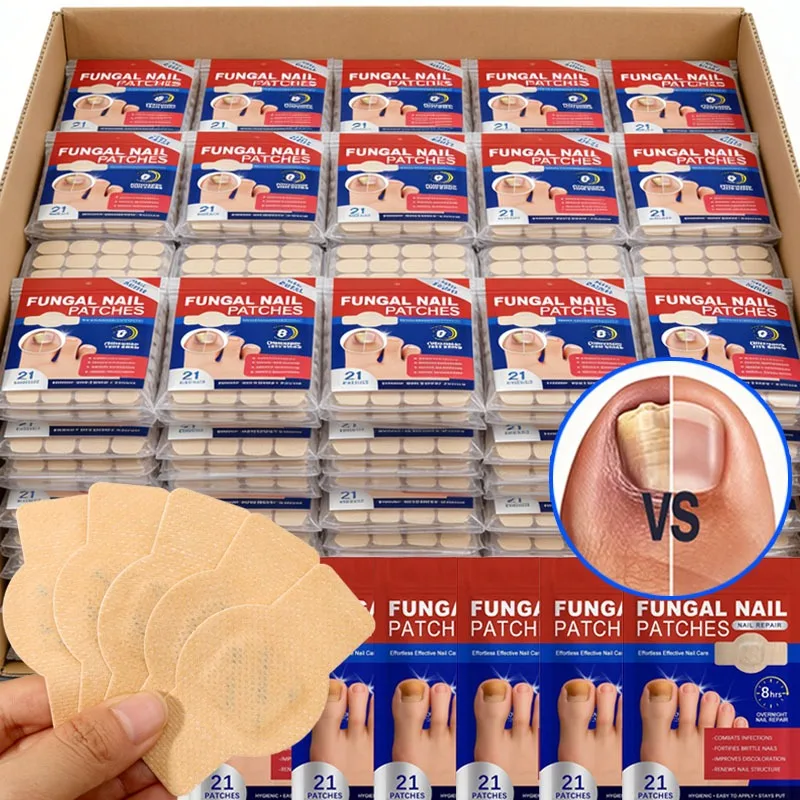 105/21pcs Nail Repair Patches Toenail Fungus Patch Care Nail Inlay Correction Sticker Paronychia Disposable Toenail Patches