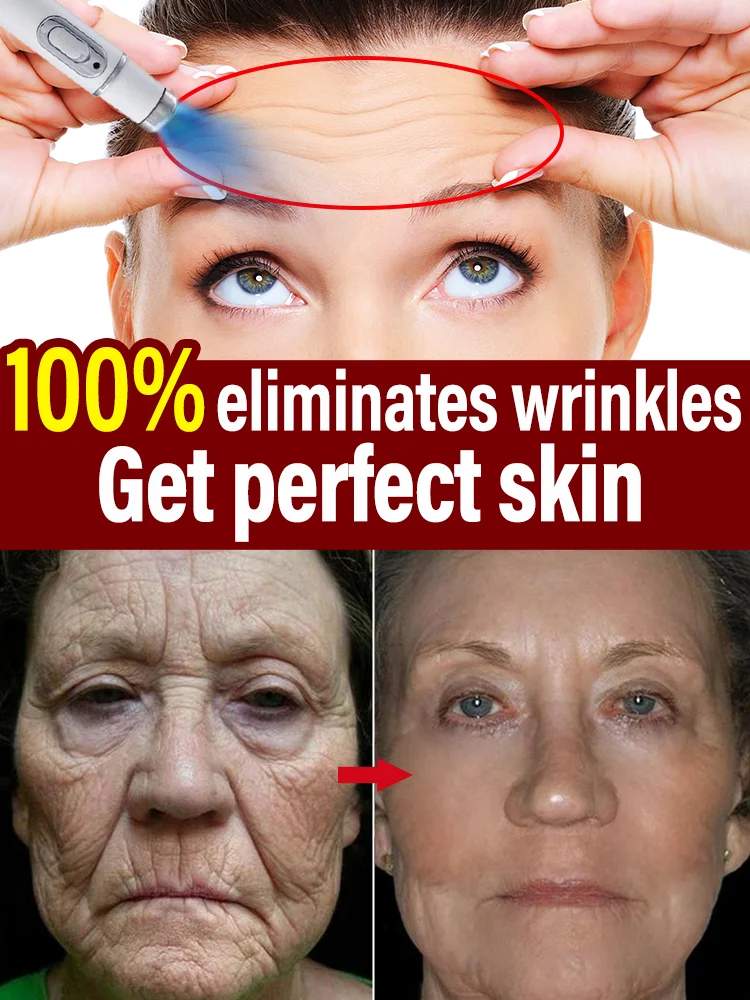 Laser Product To Solves wrinkle Problems