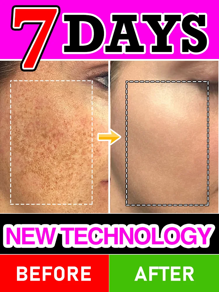 

7 Day Anti-Aging Skin Care 2025 New