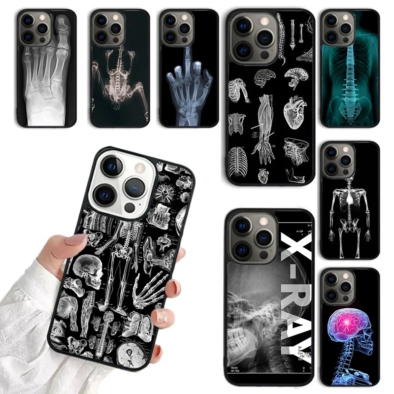 X Ray Human Anatomy Phone Case For iPhone 15 16 SE2020 11 12 13 14 Pro Max Mini Cover For iPhone Max 6 7 8 Plus coque Fundas