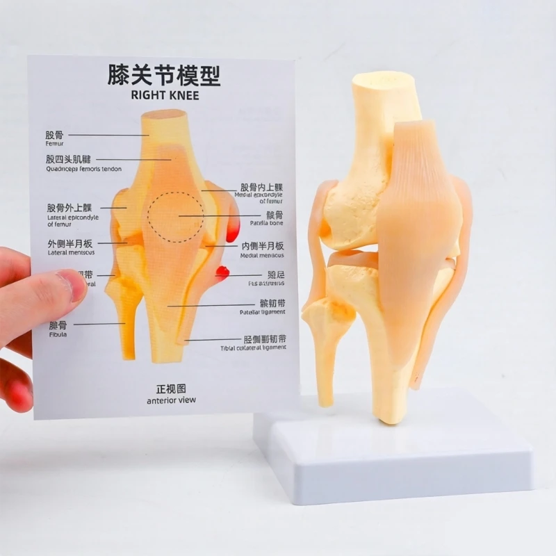  Anatomical Patella Knee Joint Model With Color Coded Muscles and Ligaments Structure For Teaching Patient Communication