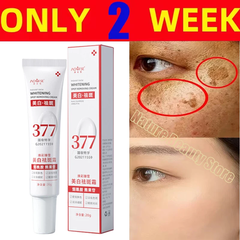 

Niacinamide Melasma Brightening Cream Reduce Melanin Brighten Cream Lighten Dark Skin Chloasma Repair Serum Face Care Products