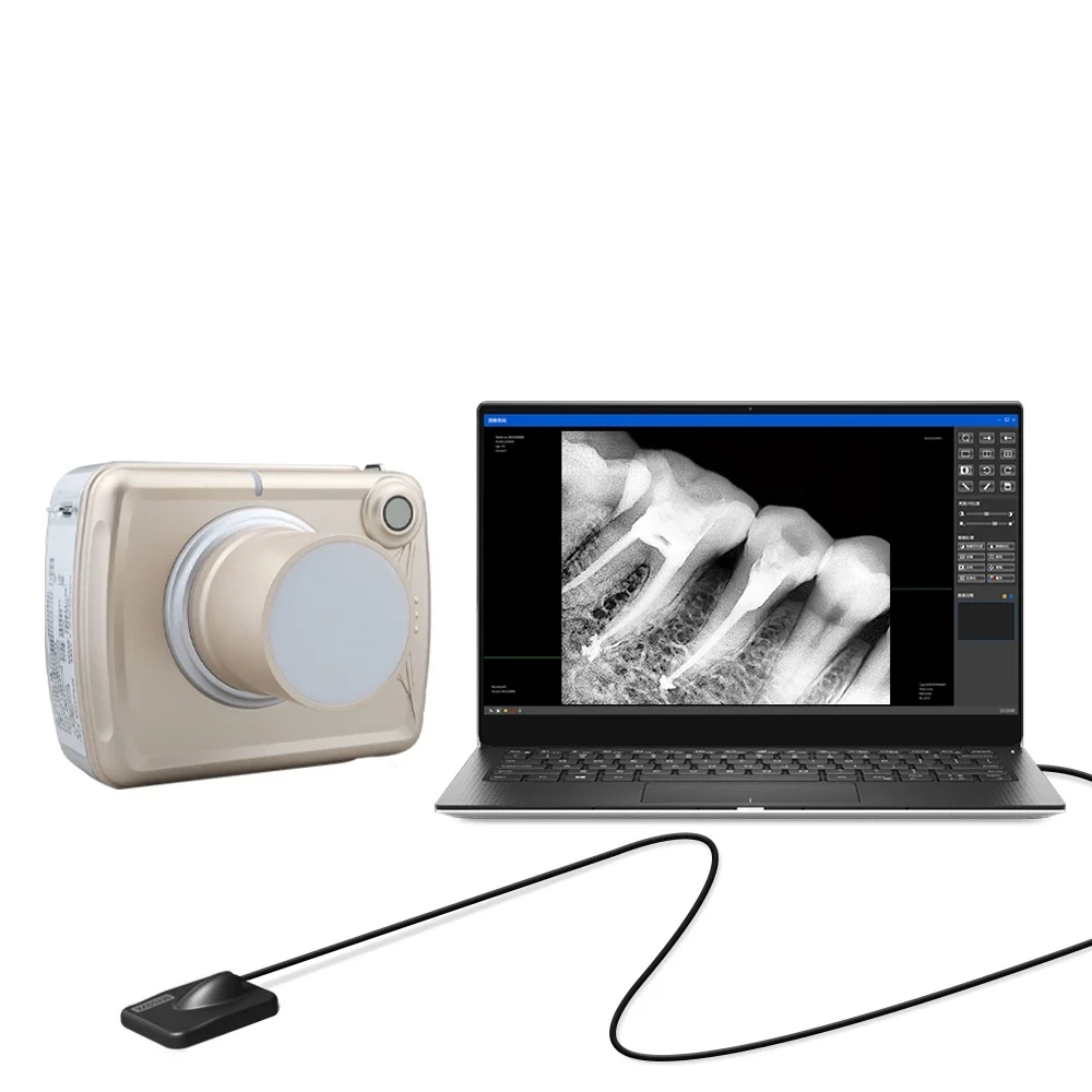 

Dental Portable Digital X-Ray With Image Sensor Kits For Veterinary Clinics Dental Equipments