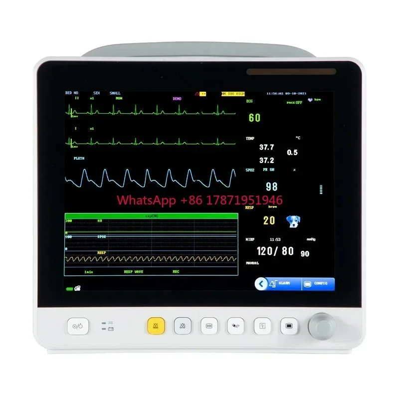 Best selling veterinary vital signs portable monitor etco2 multiparameter veterinary monitor