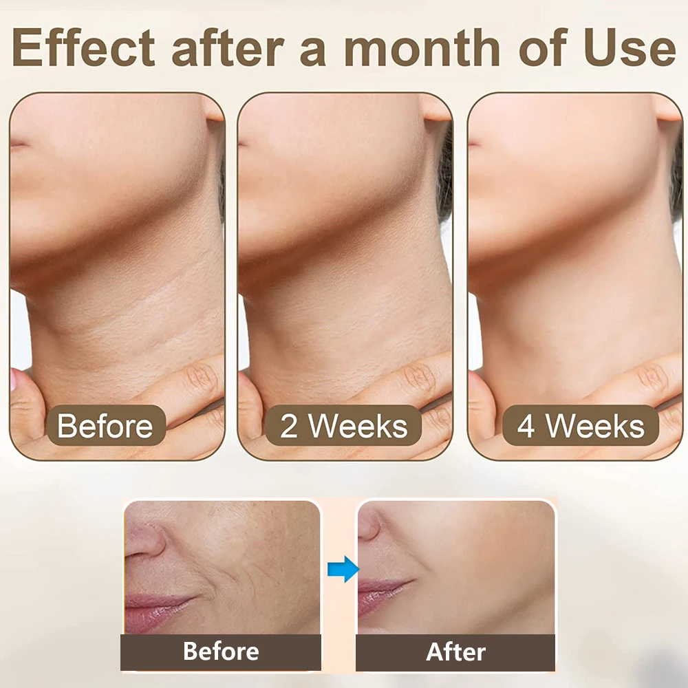 Masajeador EMS para estiramiento del cuello, dispositivo de doble barbilla, estiramiento de la piel, fotones LED, antiarrugas, rejuvenecimiento, masaje Facial