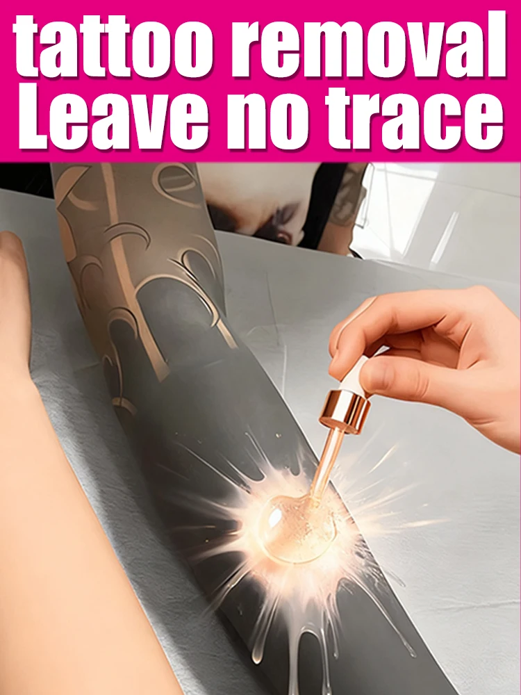Pigmented Permanent Makeup Tattoo Removal Tattoo Quick Removal