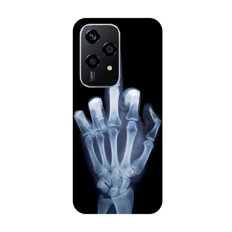 For Honor 200 Lite Case Football Soft Silicone Back Cases for Honor 200 Lite 5G 200Lite Phone Cover Honor200Lite etui Fundas