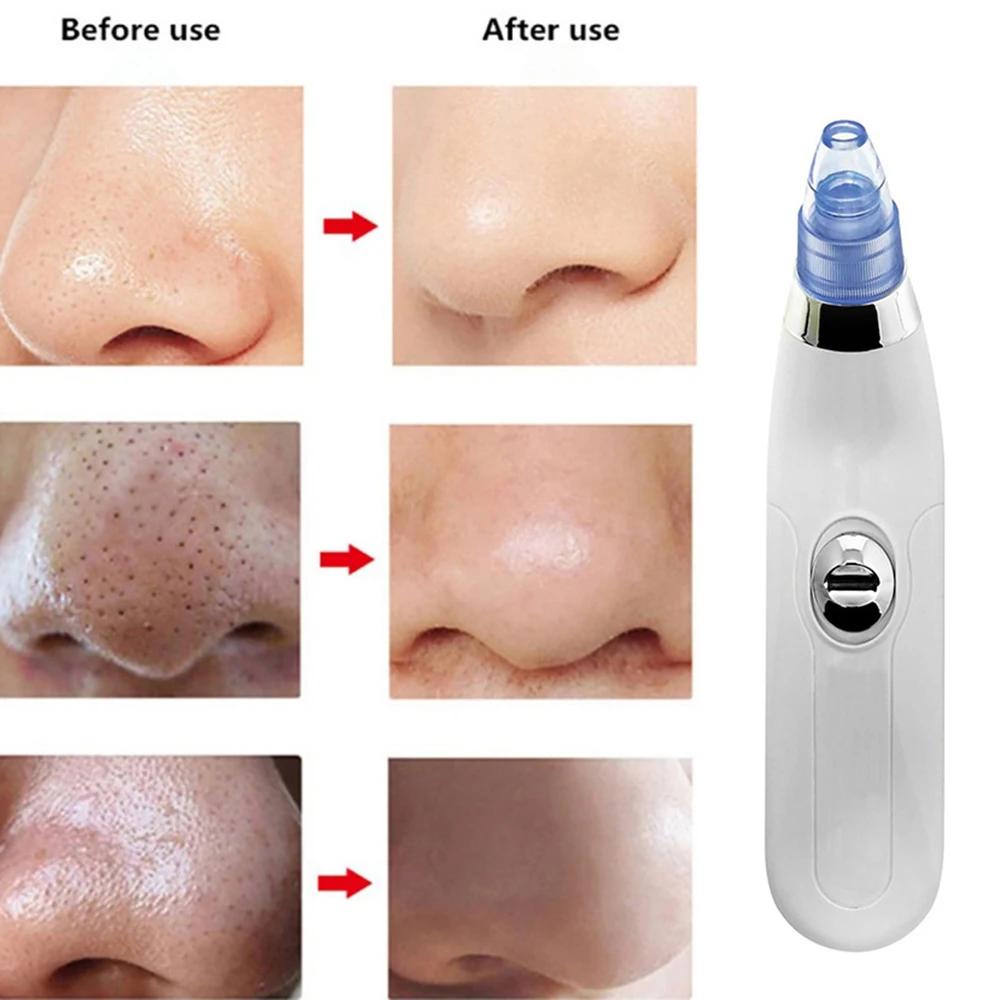 Electric Vacuum Blackhead Remover Pore Acne Black Spots Point Cleaner Extractor Machine Nose Facial Skin Care Tool Sucker Kit