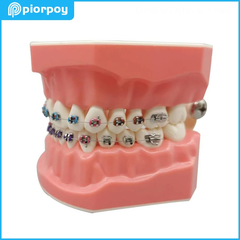 Dental Teaching Models Practice Orthodontics Teeth Model Dentistry Correction Demonstration Archwire Students Studying Training