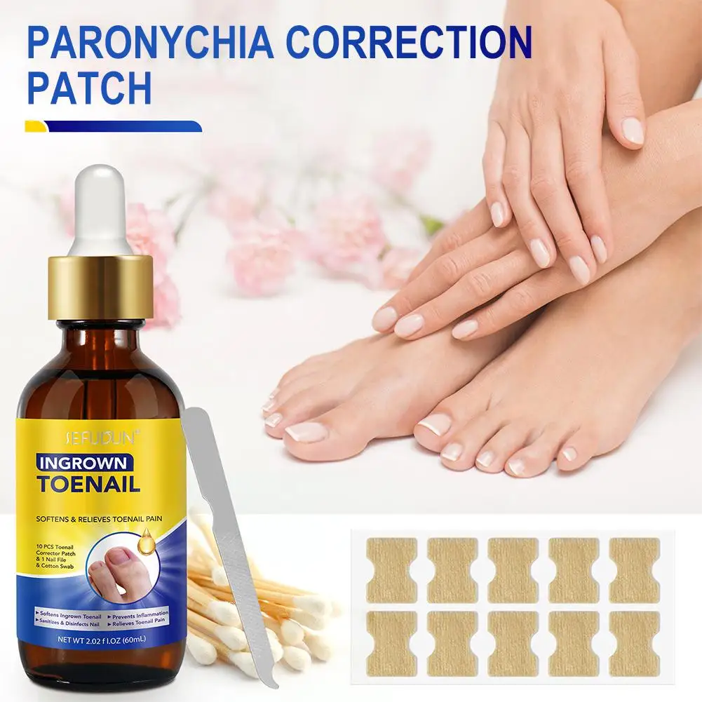 مجموعة ملصقات تصحيح الأظافر المقاومة للماء لتصحيح أظافر القدم الغارزة، علاج الداحس، استعادة العناية بالأظافر #5