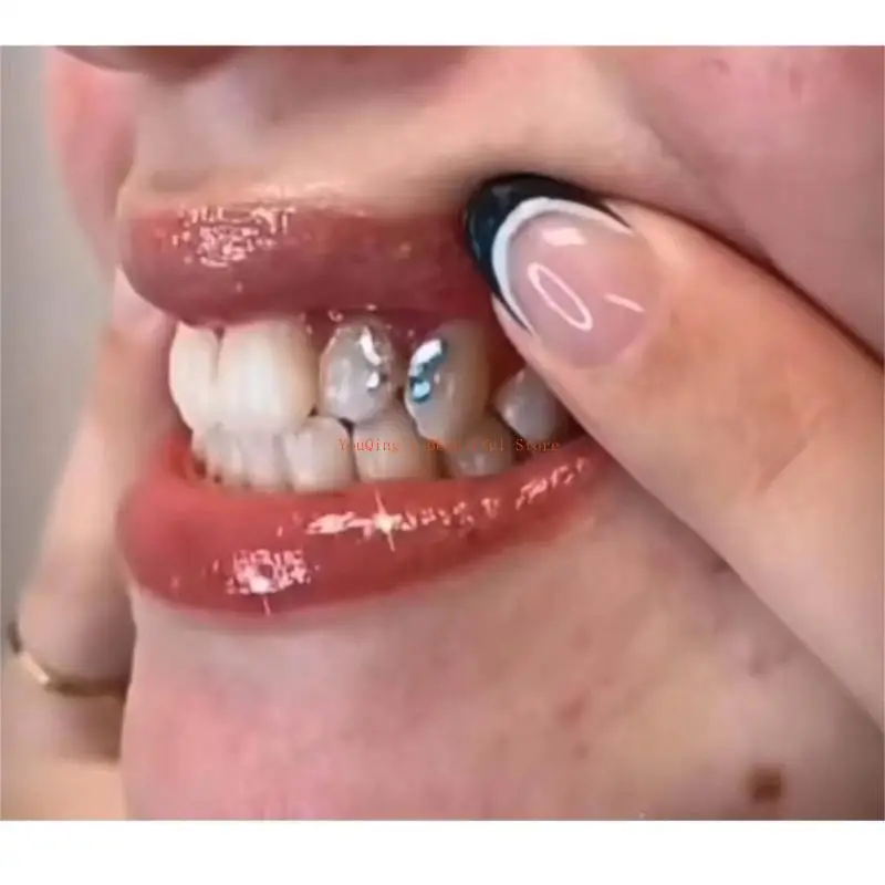 

N0HE Beauty Diamond Ornaments Acrylic Crystal Jewelry Tooth Decoration Teeth Whitening Material Special Tooth