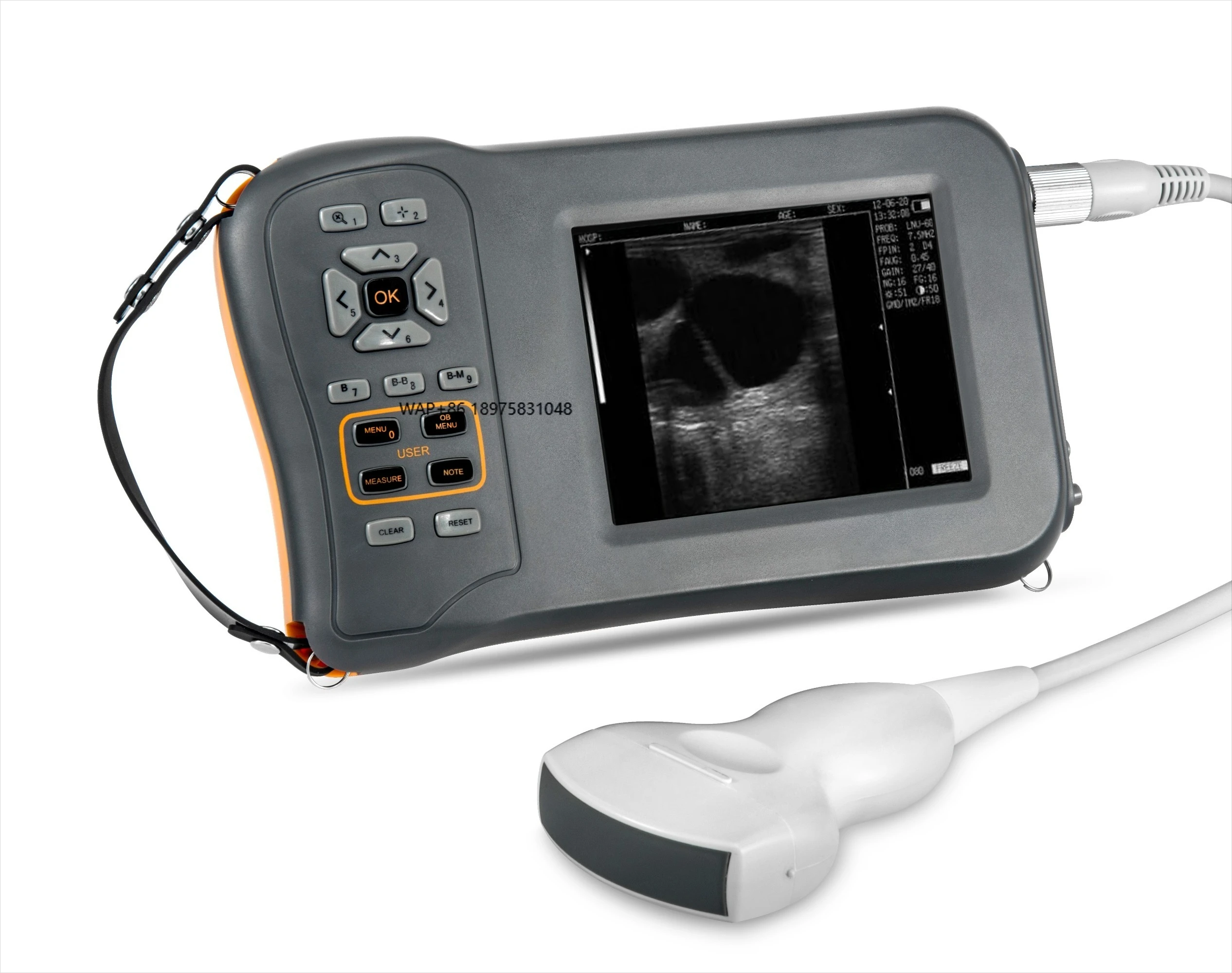 Portable L60 Veterinary Instrument for Pig, Sheep and Goat Reproductive Work and Diagnosis