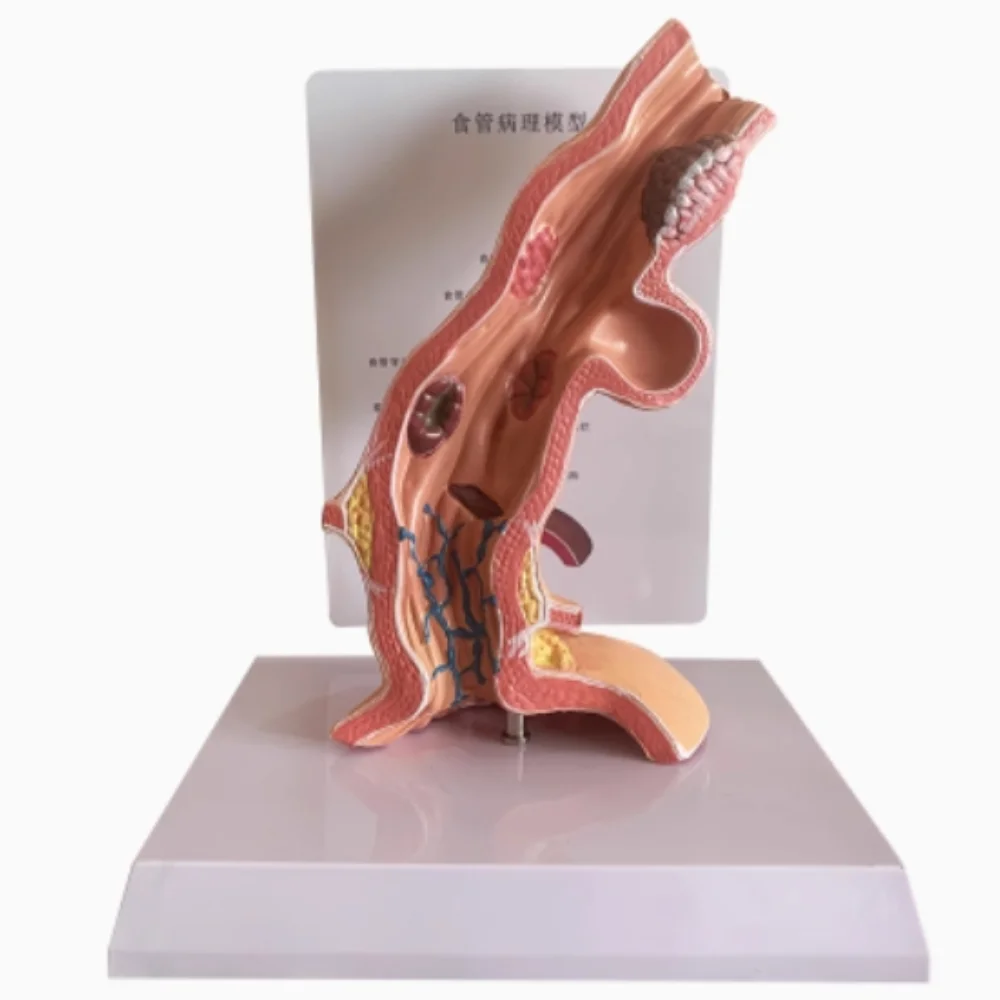 An anatomical model of the human esophagus, esophagus and stomach digestive system