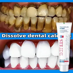 Dentifricio per la rimozione del tartaro dentale sbiancante schiarente per prevenire la parodontite alito fresco cura professionale dei denti