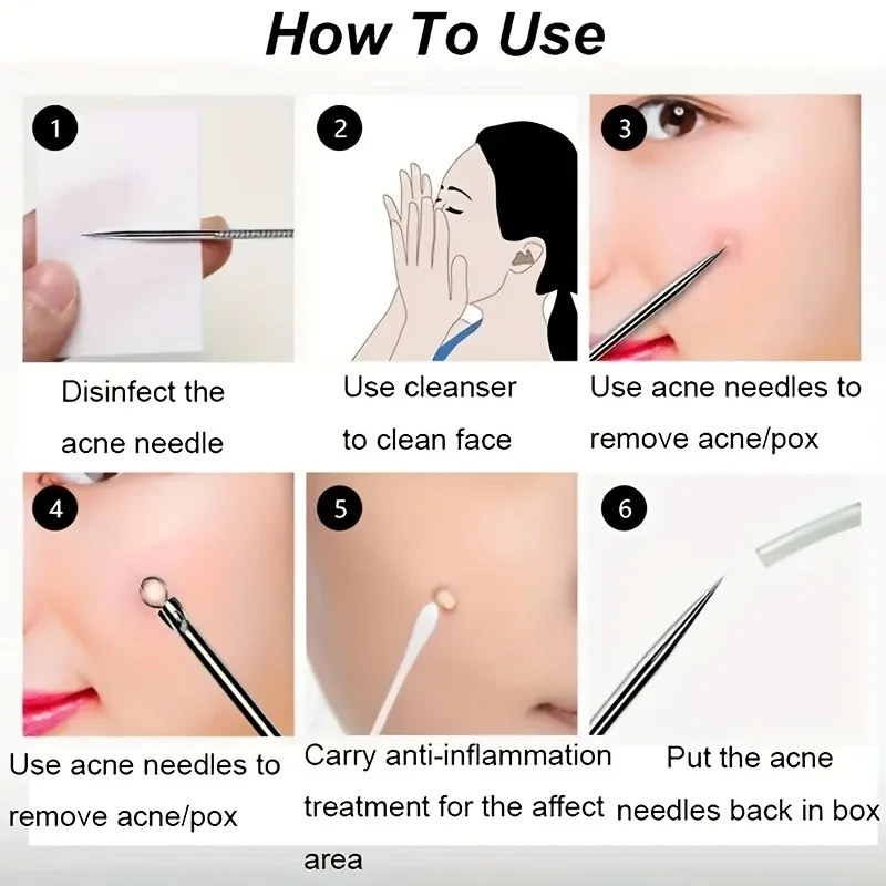 4ピースニキビ抽出セット、顔のニキビ、黒ずみ、ニキビを取り除くために使用され、肌を滑らかで柔らかくします。