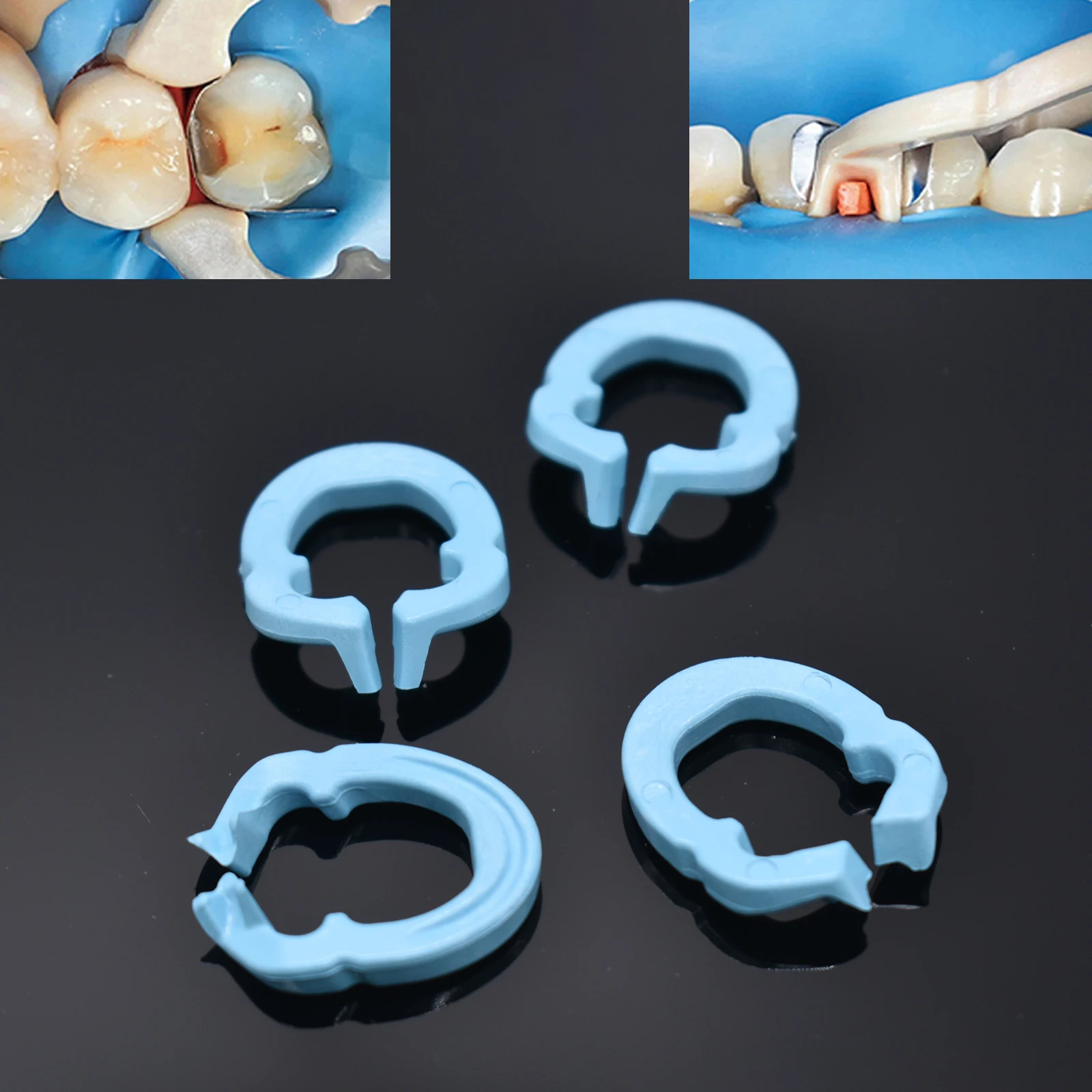 4 pçs resina dental anel de fixação separador anel secional contornado metal matrizes titular matriz braçadeira fixa autoclavable