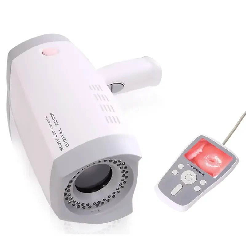 Digital Vaginal Speculum Camera SIN-CE04 for Gynecological Examination, HD Video, Medical Grade