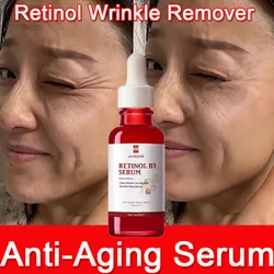 Retinol Wrinkle Remover Face Serum Instant Firming Lifting Anti-Aging Liquid Fade Fine Lines Whitening Korean Skin Care Products