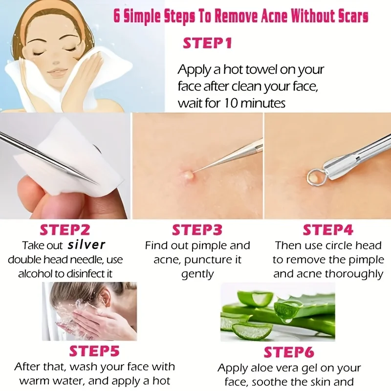 5 قطع من مستخرج الرؤوس السوداء الكوميدون، مجموعة ملاقط الرؤوس السوداء المنحنية، مجموعة أدوات احترافية من الفولاذ المقاوم للصدأ للبثور